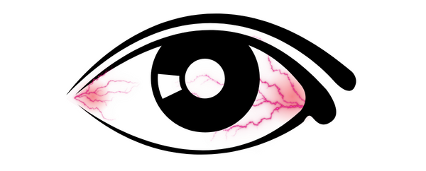 Ojos cansados y pesados